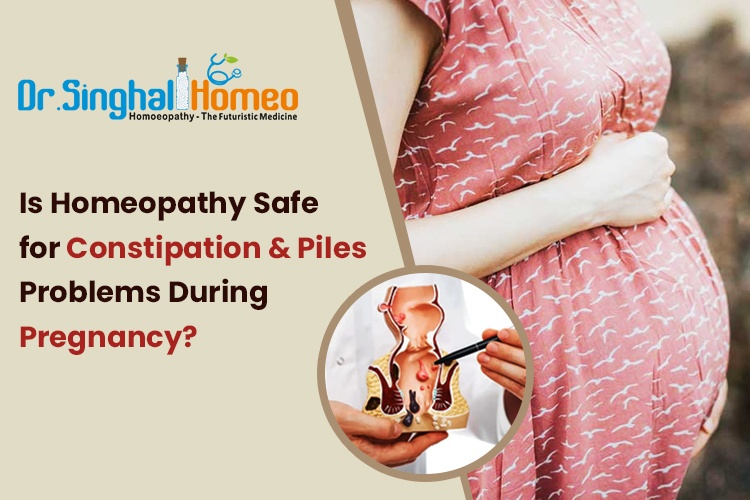 Best Homeopathic Medicine for Piles and Constipation