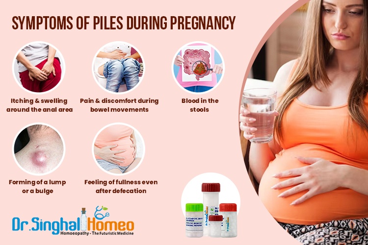 Best Homeopathic Medicine for Piles